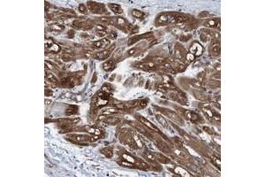 Immunohistochemical staining of human heart muscle with GARNL4 polyclonal antibody  shows distinct cytoplasmic positivity in myocytes at 1:200-1:500 dilution. (RAP1GAP2 Antikörper)