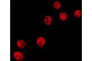 ABIN6277236 staining  Hela cells by IF/ICC.