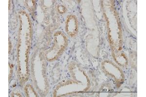 Immunostaining (ISt) image for anti-NADH Dehydrogenase (Ubiquinone) Fe-S Protein 3, 30kDa (NADH-Coenzyme Q Reductase) (NDUFS3) (AA 1-264) antibody (ABIN561943)