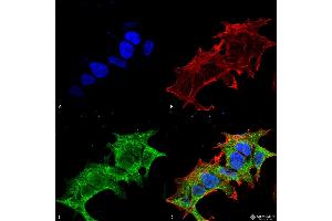 Immunocytochemistry/Immunofluorescence analysis using Mouse Anti-GIT1 Monoclonal Antibody, Clone S39B-8 . (GIT1 Antikörper  (AA 375-770) (Biotin))