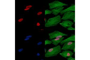 Acetyl-histone H4 (Lys16) Antibody staining A549 cells(heat shock treatment) by IF/ICC.