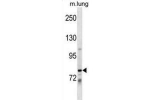 Western Blotting (WB) image for anti-Dachshund 1 (DACH1) antibody (ABIN2999622) (DACH1 Antikörper)