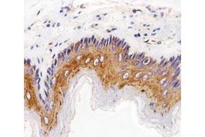 Immunohistochemical analysis of paraffin-embedded rat esophagus using EGF Receptor antibody at 1:25 dilution.
