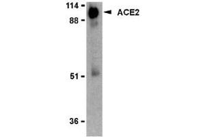 Western blot analysis of ACE2 in human kidney lysate with AP30009PU-N ACE2 antibody (IN2) at 2 μg/ml. (ACE2 Antikörper  (Intermediate Domain 2))