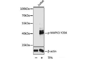 Western blot analysis of extracts of Jurkat cells using Phospho-MAPK3(Y204) Polyclonal Antibody at dilution of 1:2000. (ERK1 Antikörper  (pTyr204))