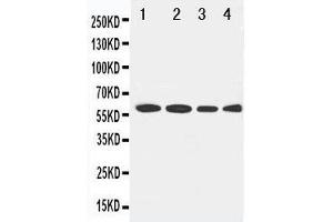 Anti-LCAT antibody, Western blotting Lane 1: Rat Brain Tissue Lysate Lane 2: U87 Cell Lysate Lane 3: HELA Cell Lysate Lane 4: SMMC Cell Lysate
