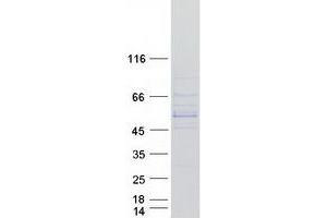 Western Blotting (WB) image for Cytochrome P450, Family 11, Subfamily B, Polypeptide 1 (CYP11B1) (Transcript Variant 2) protein (Myc-DYKDDDDK Tag) (ABIN2712751)
