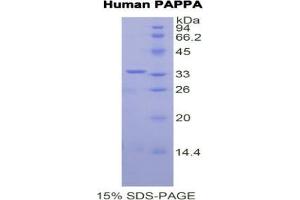 SDS-PAGE analysis of Human PAPPA Protein.