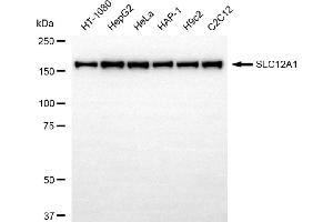 Western blotting analysis using SLC12A1 antibody (ABIN7800386).