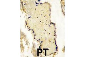 Formalin-fixed and paraffin-embedded placenta tissue reacted with SPPL2A polyclonal antibody  , which was peroxidase-conjugated to the secondary antibody, followed by DAB staining. (SPPL2A Antikörper  (N-Term))