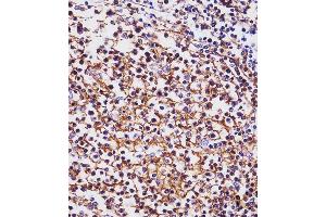 Immunohistochemistry (Paraffin-embedded Sections) (IHC (p)) image for anti-Membrane-Spanning 4-Domains, Subfamily A, Member 1 (MS4A1) (AA 266-294), (C-Term) antibody (ABIN1536600)