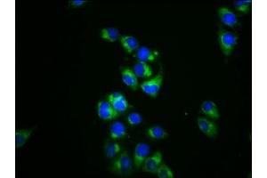 Immunofluorescence staining of Hela cells with ABIN7150934 at 1:133, counter-stained with DAPI. (DRP2 Antikörper  (AA 697-833))