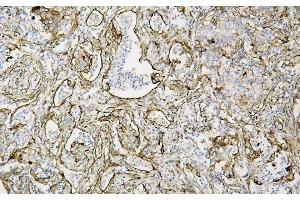 IHC analysis of Caveolin-1/CAV1 using anti-Caveolin-1/CAV1 antibody (ABIN6719534).