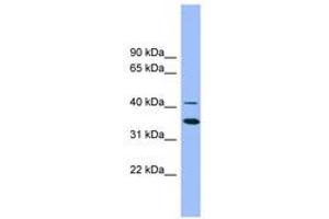 Image no. 1 for anti-GATA Binding Protein 5 (GATA5) (AA 323-372) antibody (ABIN6742225) (GATA5 Antikörper  (AA 323-372))