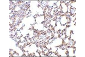 Immunohistochemistry of SnoN in mouse lung tissue with this product at 5 μg/ml. (SKIL Antikörper  (N-Term))