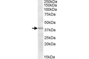 TXNDC6 polyclonal antibody  (2 ug/mL) staining of human uterus lysate (35 ug protein in RIPA buffer). (NME9 Antikörper)
