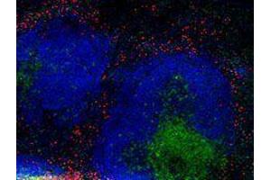 Immunofluorescence (IF) image for anti-Integrin beta 2 (ITGB2) antibody (Alexa Fluor 594) (ABIN2656819) (Integrin beta 2 Antikörper  (Alexa Fluor 594))
