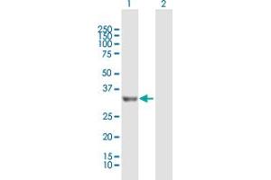 Western Blot analysis of PROSC expression in transfected 293T cell line by PROSC MaxPab polyclonal antibody. (PROSC Antikörper  (AA 1-275))