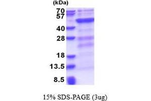 SDS-PAGE (SDS) image for DNA (Cytosine-5-)-Methyltransferase 3 Like (TRDMT1) (AA 1-387) protein (His tag) (ABIN6387414)
