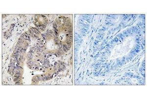 Immunohistochemistry (IHC) image for anti-Carbamoyl-Phosphate Synthetase 2, Aspartate Transcarbamylase, and Dihydroorotase (CAD) (pThr456) antibody (ABIN1847749) (CAD Antikörper  (pThr456))