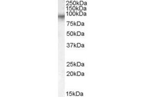 Western Blotting (WB) image for anti-Coagulation Factor XIII, A1 Polypeptide (F13A1) (AA 703-717) antibody (ABIN291434) (F13A1 Antikörper  (AA 703-717))