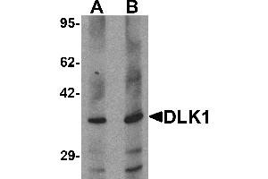 Western blot analysis of HepG2 in 293 cell lysate with DLK1 antibody at (A) 1 and (B) 2 µg/mL. (DLK1 Antikörper  (C-Term))