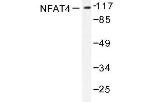 Image no. 1 for anti-Nuclear Factor of Activated T-Cells, Cytoplasmic, Calcineurin-Dependent 3 (NFATC3) antibody (ABIN272044)