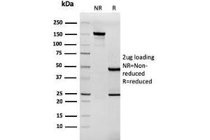 SDS-PAGE Analysis Purified Tenascin C Mouse Recombinant Monoclonal Antibody (TNC/3635). (Rekombinanter TNC Antikörper)