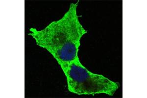 Confocal immunofluorescence analysis of Hela cells using DAXX antibody (green). (DAXX Antikörper)