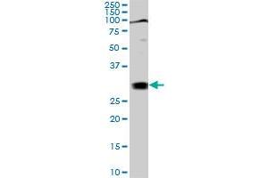 TGIF2 monoclonal antibody (M02), clone 5B11. (TGIF2 Antikörper  (AA 131-236))