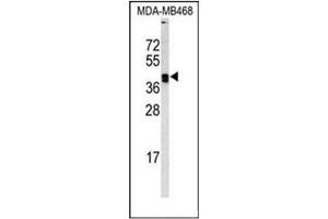 Western blot analysis of  Lysyl oxidase Antibody (Center) in MDA-MB468 cell line lysates (35ug/lane).