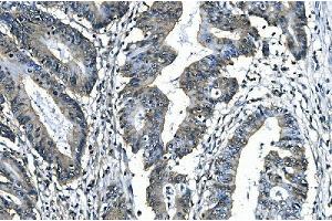 IHC analysis of SLBP using anti-SLBP antibody (ABIN7600074). (SLBP Antikörper  (AA 146-270))