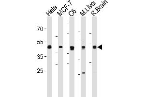 MEK2 (P2K2) Antibody (N-term) (ABIN1882178 and ABIN2842061) western blot analysis in Hela,MCF-7,rat C6 cell line and mouse Liver,rat Brain tissue lysates (35 μg/lane). (MEK2 Antikörper  (N-Term))