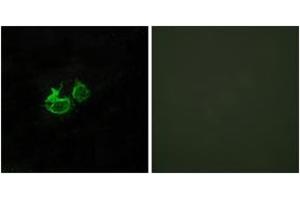 Immunofluorescence analysis of HuvEc cells, using GHRHR Antibody. (GHRHR Antikörper  (AA 351-400))