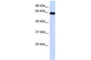Image no. 1 for anti-Hypermethylated in Cancer 2 (HIC2) (AA 395-444) antibody (ABIN6742231) (HIC2 Antikörper  (AA 395-444))
