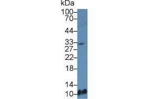 Western Blot; Sample: Mouse Spleen lysate; Primary Ab: 5µg/ml Rabbit Anti-Mouse MDC Antibody Second Ab: 0. (CCL22 Antikörper  (AA 29-92))