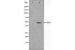 Western blot analysis on LOVO cell lysate using HAT Antibody,The lane on the left is treated with the antigen-specific peptide. (HAT1 Antikörper  (C-Term))