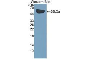Detection of Recombinant IL35, Human using Polyclonal Antibody to Interleukin 35 (IL35) (Interleukin 35 Antikörper  (AA 23-219))