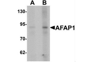Western blot analysis of AFAP1 in Hela cell lysate with AFAP1 antibody at (A) 1 and (B) 2 ug/ml.