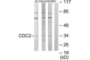 Western Blotting (WB) image for anti-Cyclin-Dependent Kinase 1 (CDK1) (Internal Region) antibody (ABIN1849110) (CDK1 Antikörper  (Internal Region))