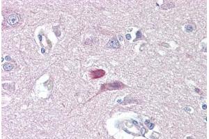 Anti-GRM4 / MGLUR4 antibody IHC staining of human brain, cortex. (Metabotropic Glutamate Receptor 4 Antikörper  (AA 851-900))