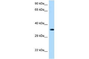 WB Suggested Anti-March2 Antibody Titration: 1. (MARCH2 Antikörper  (Middle Region))