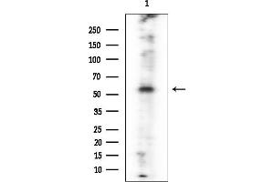 anti-Paired Box 3 (PAX3) (Internal Region) antibody