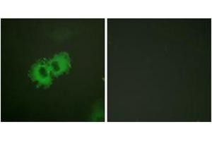 Immunofluorescence analysis of HeLa cells, using Caldesmon (Phospho-Ser789) Antibody. (Caldesmon Antikörper  (pSer789))