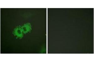 Immunofluorescence analysis of HeLa cells, using Caldesmon (Phospho-Ser789) Antibody. (Caldesmon Antikörper  (pSer789))