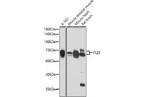 Western blot analysis of extracts of various cell lines, using PLZF antibody (ABIN6128472, ABIN6150368, ABIN6150369 and ABIN6221570) at 1:2654 dilution. (ZBTB16 Antikörper  (AA 1-220))