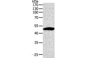 Western blot analysis of Mouse thymus tissue, using SIRT6 Polyclonal Antibody at dilution of 1:350 (SIRT6 Antikörper)
