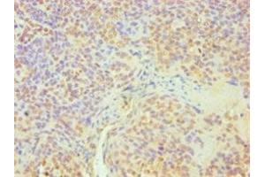 Immunohistochemistry (IHC) image for anti-DEAD (Asp-Glu-Ala-Asp) Box Polypeptide 5 (DDX5) (AA 1-290) antibody (ABIN7164363)