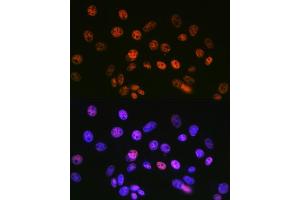 Immunofluorescence analysis of NIH-3T3 cells using mSin3A Rabbit mAb (ABIN7270318) at dilution of 1:100 (40x lens). (SIN3A Antikörper)