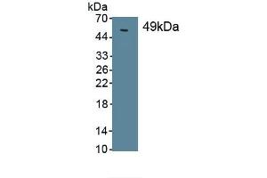 Detection of Recombinant SPC, Human using Monoclonal Antibody to Surfactant Protein C (SP-C) (Surfactant Protein C Antikörper  (AA 24-197))